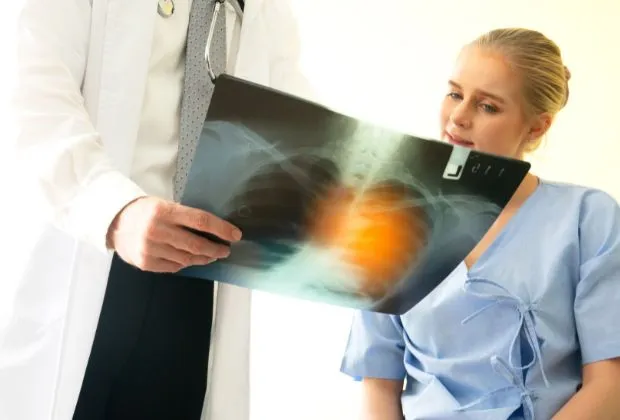 Role of Inflammation in the Pathogenesis of Lung Cancer