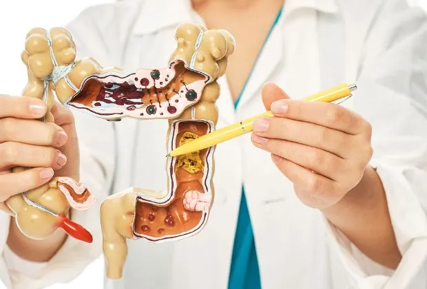 The Role of the Gut Microbiota in Multiple Sclerosis