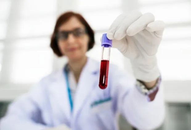 Lab Tests for Hemophilia