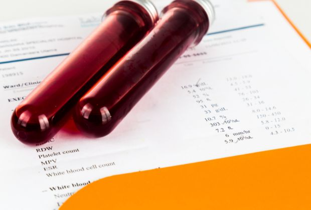 HbA1c Test: Understanding the Procedure, Results And Interpretation