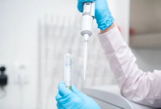 CCP Antibody Test - Purpose and Procedure