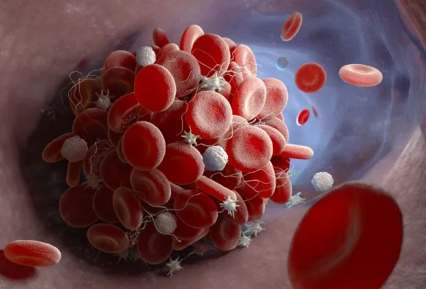 The Immune Response of Factor VIII: An Overview