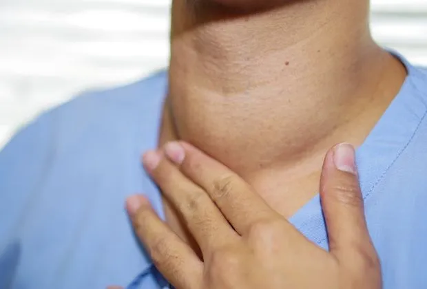 Lithium-Induced Goiter - Diagnosis and Treatment