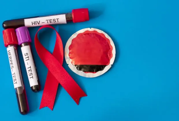 HIV Testing - An Overview