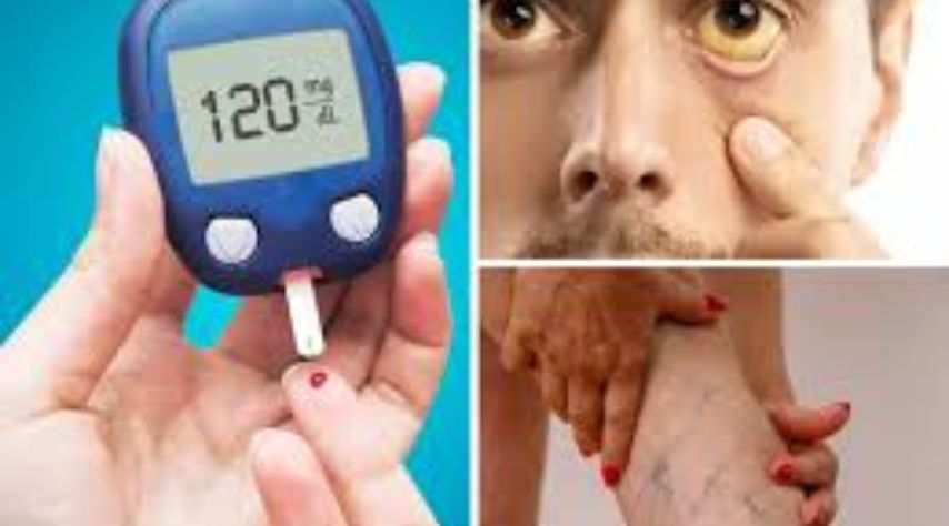 Common Symptoms of Type 2 Diabetes
