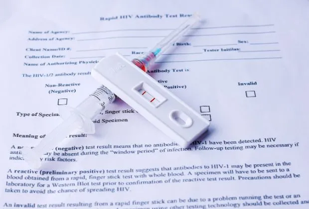 Rapid HIV Tests - Procedure, Significance, Benefits, and Results