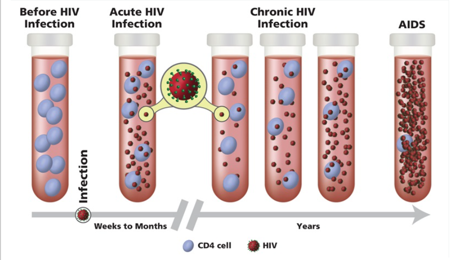 Disease Progression in HIV