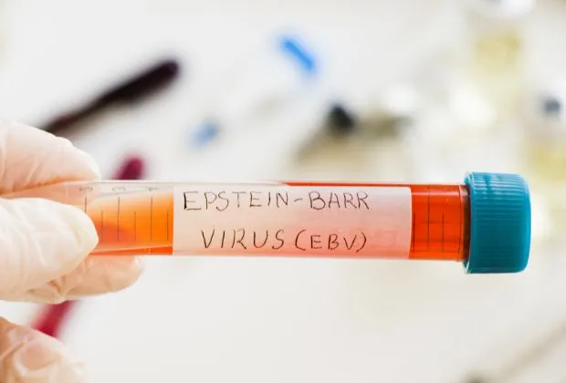 Exploring the Link Between Epstein-Barr Virus and Multiple Sclerosis