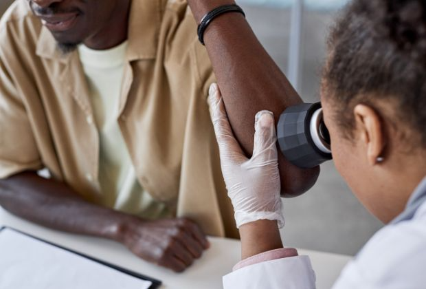 Skin Tuberculosis - Causes, Symptoms, Treatment, and Prevention