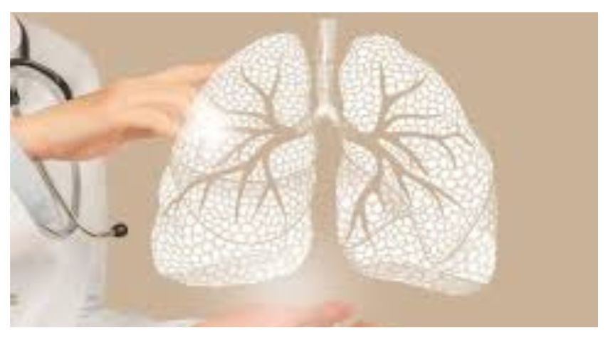 Dealing with treatment Side Effects in non-small cell lung cancer