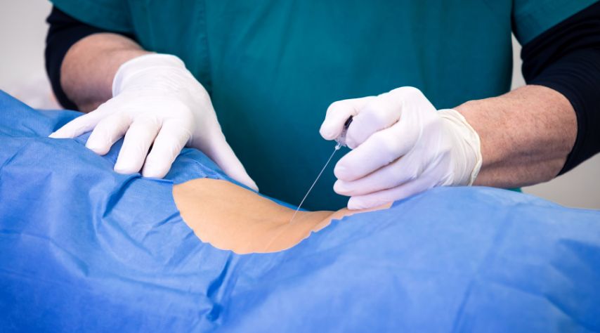 Prevention and Early Detection of MS