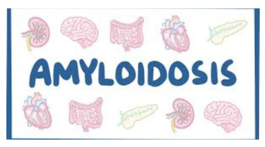 What is Amyloidosis?