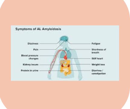 Understanding the Symptoms of Amyloidosis