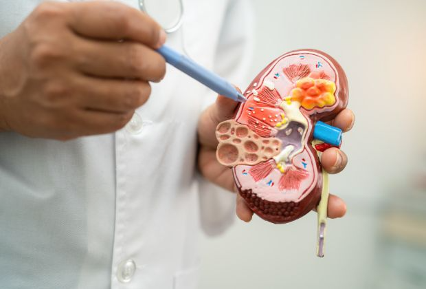 Aristolochic Acid Nephropathy - Symptoms, Diagnosis, and Treatment