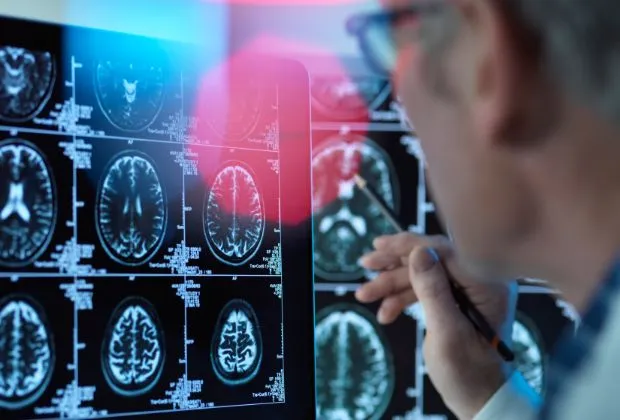 Understanding the Impact of Multiple Sclerosis on Brain Function