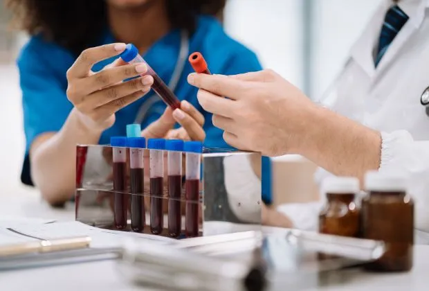 Understanding  Functions and Significance of Rheumatoid Factor