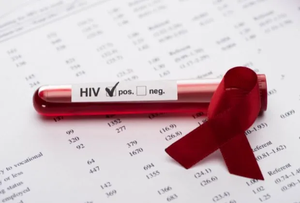 Myths and Facts About HIV and AIDS