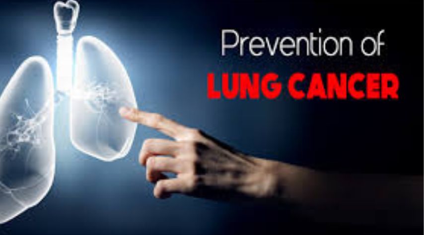 Prevention of non-small cell lung cancer