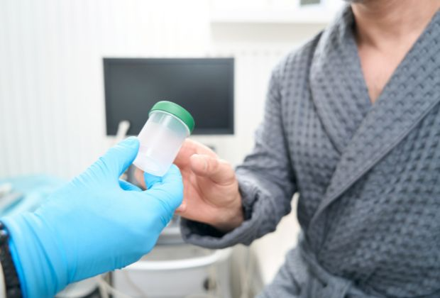 Acid-Fast Bacteria Test - Indications, Procedure, and Result