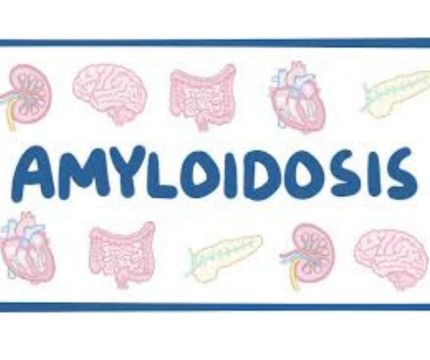 Amyloidosis- Understanding the Complexities of a Protein Misfolding Disorder