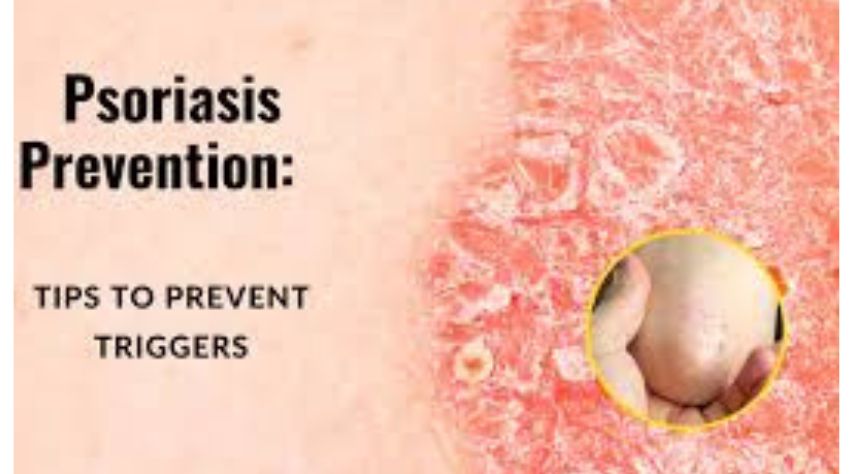 Preventive Measures 

