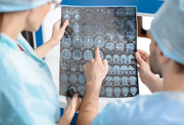Can an MRI Diagnose Migraine?