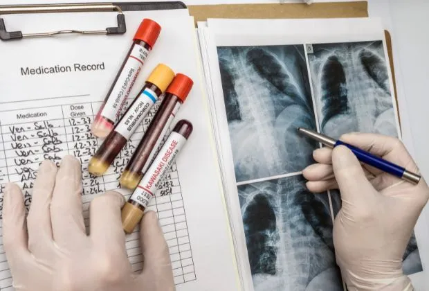 Lung Cancer Biomarkers - An Overview