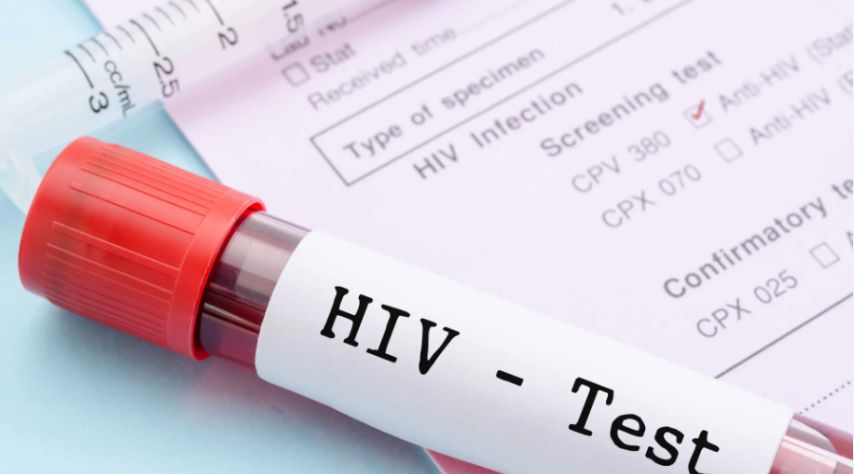 Diagnosing HIV