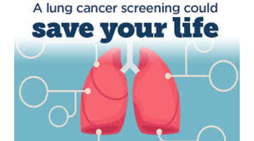 Screening for non-small cell lung cancer