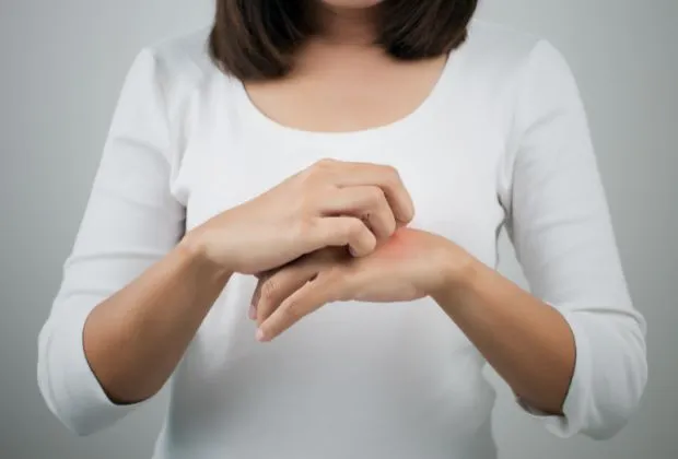 iCliniq | Atopic Dermatitis